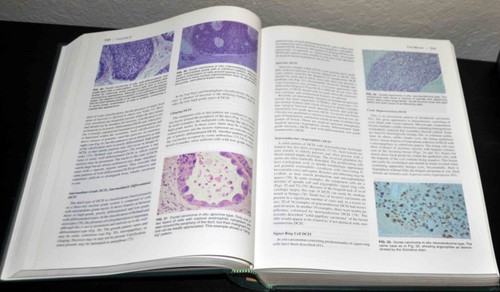 DIAGNOSTIC SURGICAL PATHOLOGY, Sternberg. The 2-Volume Set - Picture 5 of 7