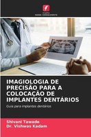 Imagiologia DE PrecisÃO Para A ColocaÇÃO DE Implantes DentÁRios Shivani Tawade