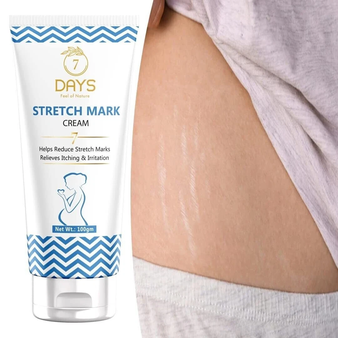 Best cream for old stretch marks deals