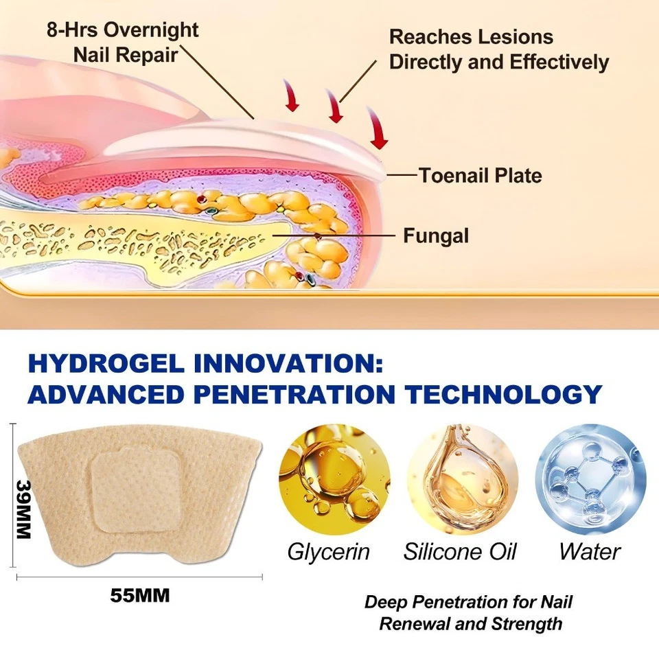 Parches de uñas para hongos 64 piezas - Tratamiento de hongos en las uñas de los pies extra fuerte durante la noche Foto 3 de 4