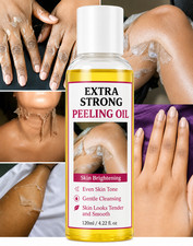 Extra Strong Peeling Oil 120ml Skin Brightening Dark Spots Scars Stretch Marks