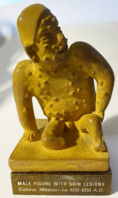 VINTAGE SCHERING MALE FIGURE W SKIN LESIONS STATUE COLIMA MEXICO PAPER WEIGHT