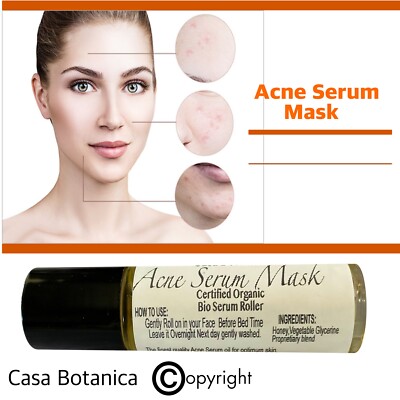 2 pcs Acne Serum Roll On Mask  Casa Botanica