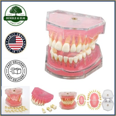 Dental Simulation Model, Soft Rubber Gingiva and Removable Upper and Lower Jaws