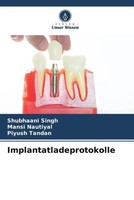 Shubhaani Singh (U. A.) | Implantatladeprotokolle | Taschenbuch | Deutsch (2022)