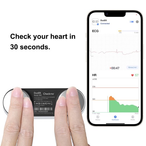 Mobile EKG Heart Monitor Chest Strap & Handheld Measure free AI-ECG Analysis - Picture 3 of 13