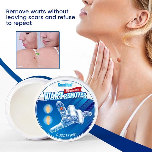 1-3pcs Wart Removal Body Warts Treatment Cream Foot Care Cream Skin Tag Remove r - Picture 9 of 17