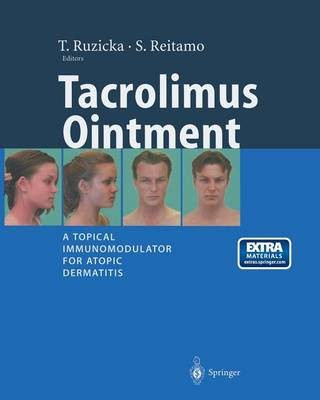 Tacrolimus Ointment - 9783662102114