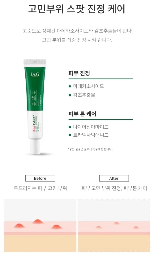 Dr.G R.E.D Blemish Clear Soothing Spot Balm 30ml Acne Skin Care K-Beauty - Image 4 of 4