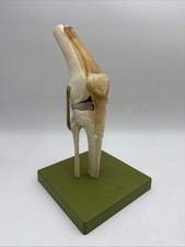 Somso NS50 Functional Knee Joint with Ligaments Anatomical Model NS 50