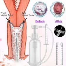 300ml Pump Action Douche Enema Bottle with Nozzle Vaginal Anal Cleaning Unisex