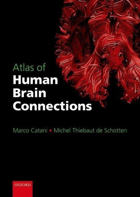 Thumbnail - Atlas Of Human Brain Connections | Marco Catani, Michel Thiebaut De