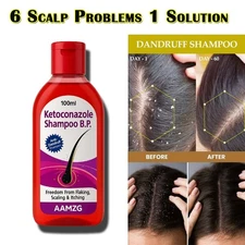 AAMZG Anti Dandruff Shampoo - Shampoo for Men & Women for Flaky, Itchy, Oily,