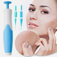 Auto Micro Skin Tag Remover Device Kit Safe Painless Removal 2-8 mm Band Tool
