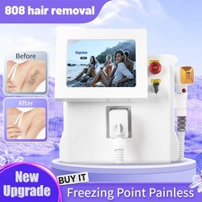 808 Diode Laser Hair Removal Yag 755 808 1064 Diode Laser Hair Removal Machine