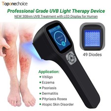 308nm UVB Phototherapy Device Handheld Adjustable for Skin Care Home Use 49pcs