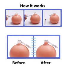 1 Set Nipple Corrector Device Correction For Inverted Nipples Treatment Enlarger