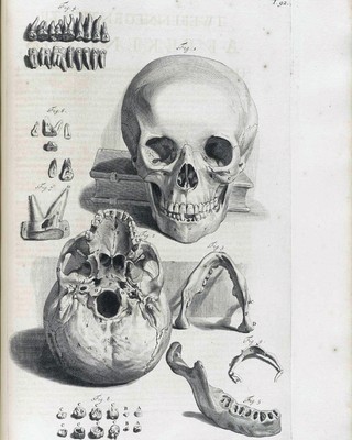 Vintage Medical Illustration Skull Teeth Dental Anatomy Real Canvas Art Print 2