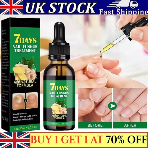 Ginger Nail Treatment Nail Care, Nail Growth Oil for Cuticle Nourishment UK - Picture 1 of 10