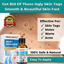 Skin Tag Mole Remover Wart Remover Liquid Eliminate Feet Corn Wart Remove Liquid