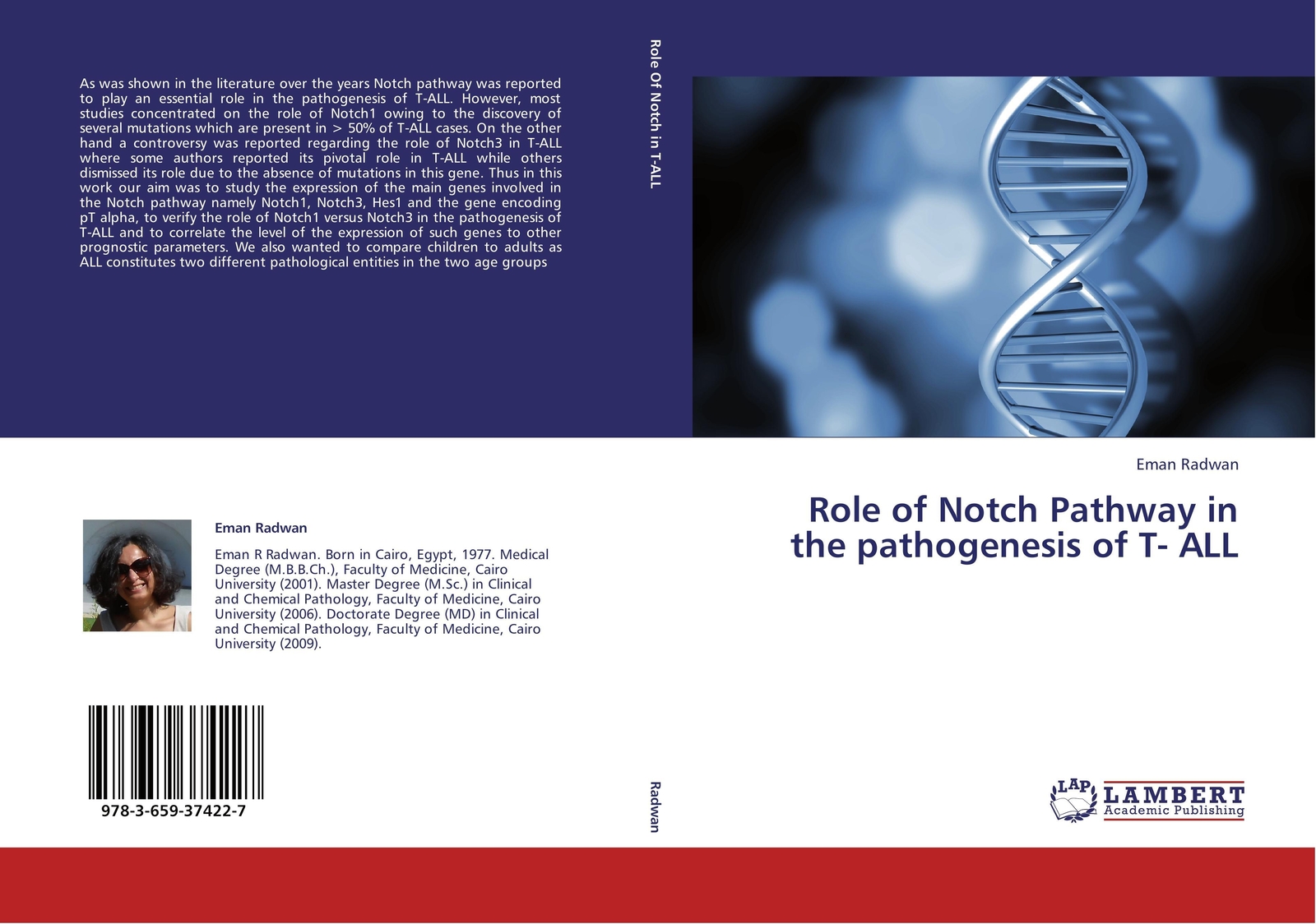 Thumbnail - Eman Radwan | Role Of Notch Pathway In The Pathogenesis Of T- All |