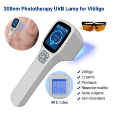 49 Diodes 308nm UVB Phototherapy Targeted Lamp for Skin Conditions Improvement