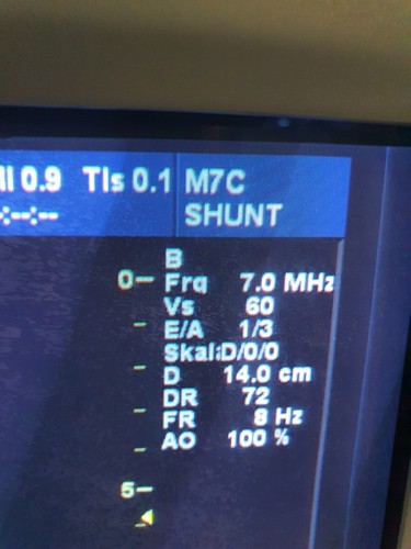 Ultraschallsonde Probe Transducer GE M7C - Bild 6 von 7