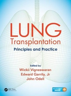 Lung Transplantation - 9781482233919