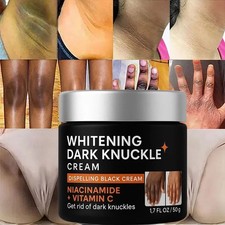 Strong Whitening Cream For Removing Dark Knuckle Finger Elbow and Knee USA