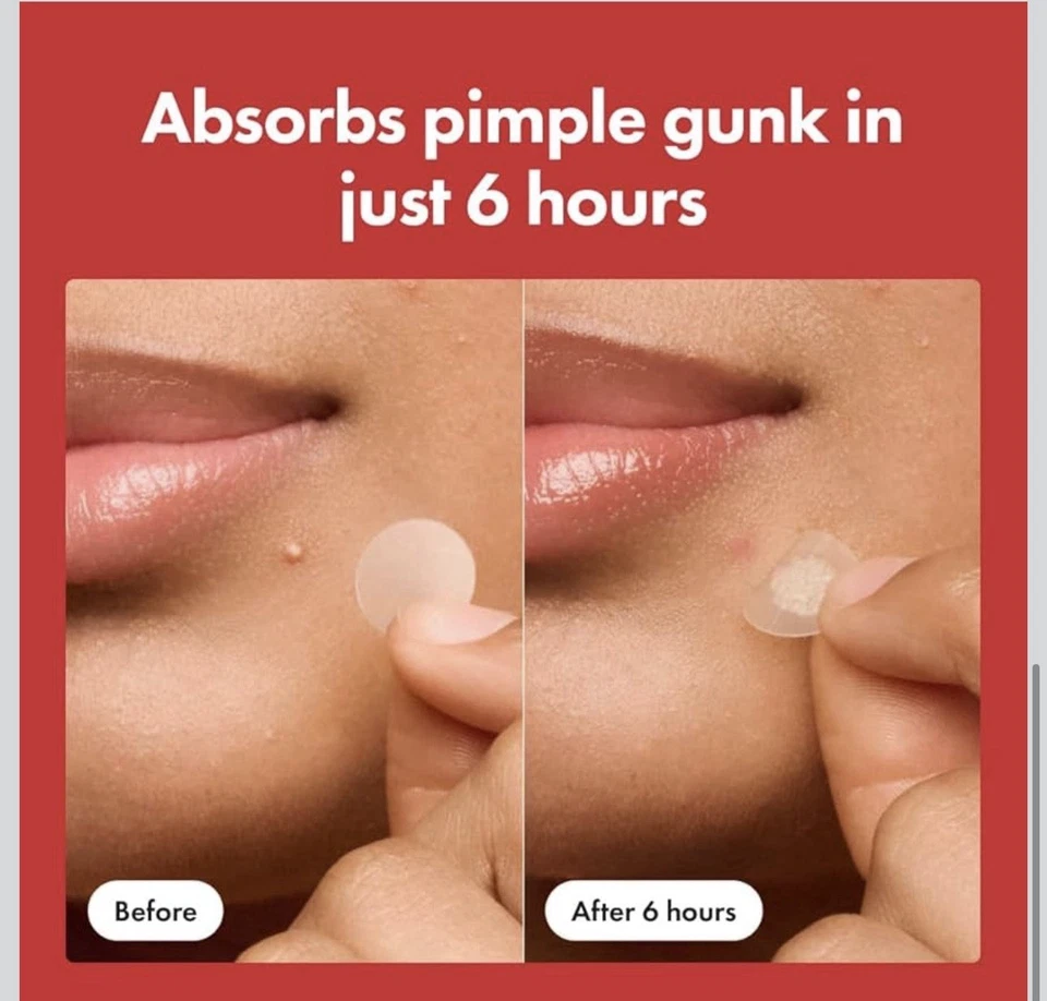 Mighty Patch patch from Hero Cosmetics Nighttime Spot Stickers - 36 Count - Image 4 of 4