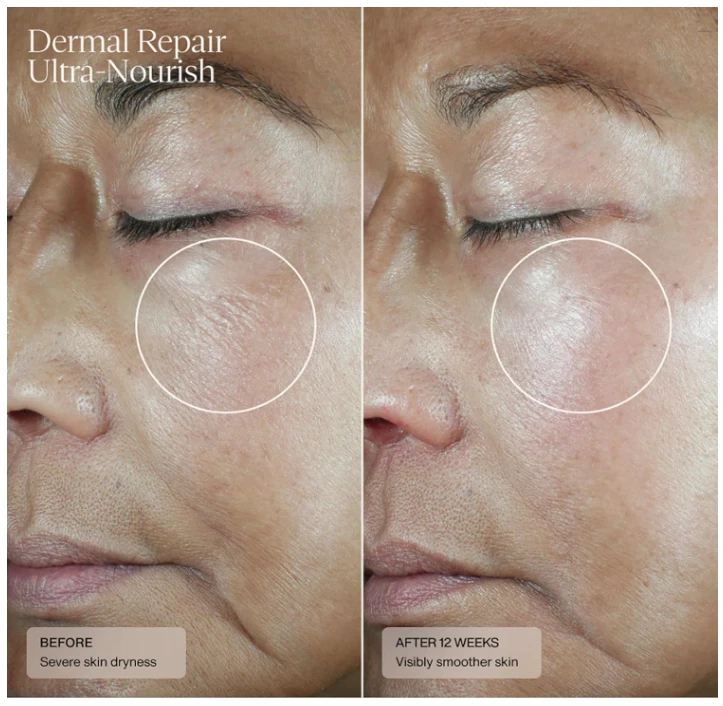 Sente Dermal Repair Ultra-Nourish Cream Anti-Aging 0.5oz/15mL Exp. 10/27 - Image 4 of 4