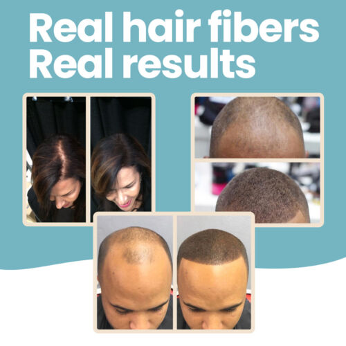 Hair Thickening Fibers by HAIR ILLUSION- Instant Natural Scalp Bald Spot Remover - Picture 1 of 12