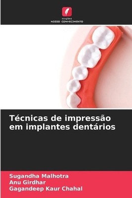 Tcnicas de impresso em implantes dentrios by Sugandha Malhotra (Portuguese) Pape