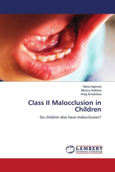 Class II Malocclusion In Children Do Children Also Have Malocclusion? Buch 2021-image