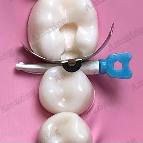 Matrices de cuñas dentales Tulwar cuña diastema ajuste Palodent Plus estilo matriz W5 - Imagen 3 de 8