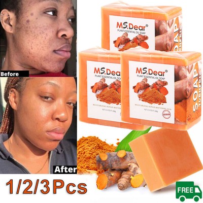 3-1x Tumeric Soap Skin Whitening Dark Spots lightening Acne Brightening Turmeric