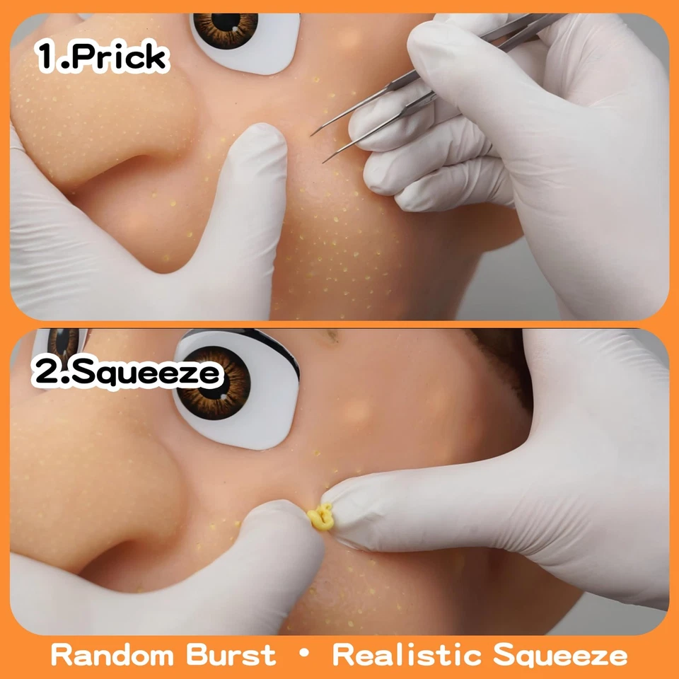 2026 New Pimple Popping Stress Relief Toy – Refillable Big Head Squeeze Pimpl... - Image 3 of 4
