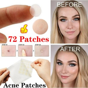 pimple patch for dark spots
