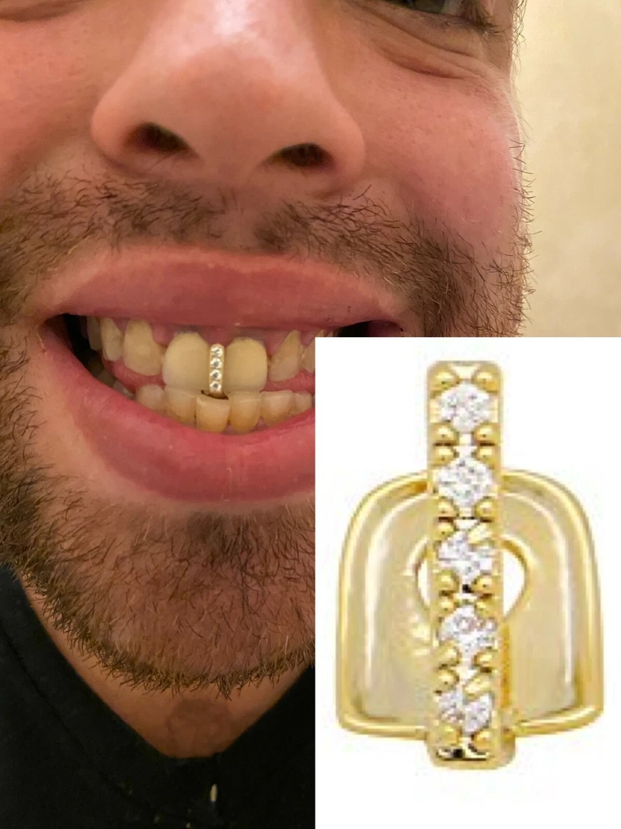 Gap grillz 2024