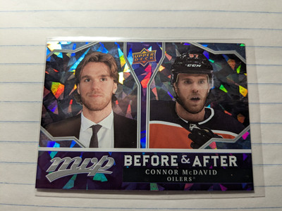 2021-22 Upper Deck MVP - Before and After #BA-2 Connor McDavid