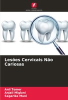 Anil Tomer (U. A.) | LesõEs Cervicais NãO Cariosas | Taschenbuch | Portugiesisch