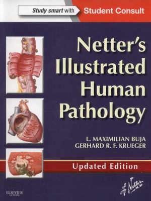 Netter's Illustrated Human Pathology Updated Edition