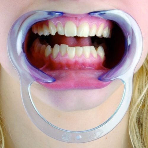 10 Pcs Mouth C Shape Opener Dental Cheek Retractor Fun Game Watch Large Size L - Picture 1 of 10