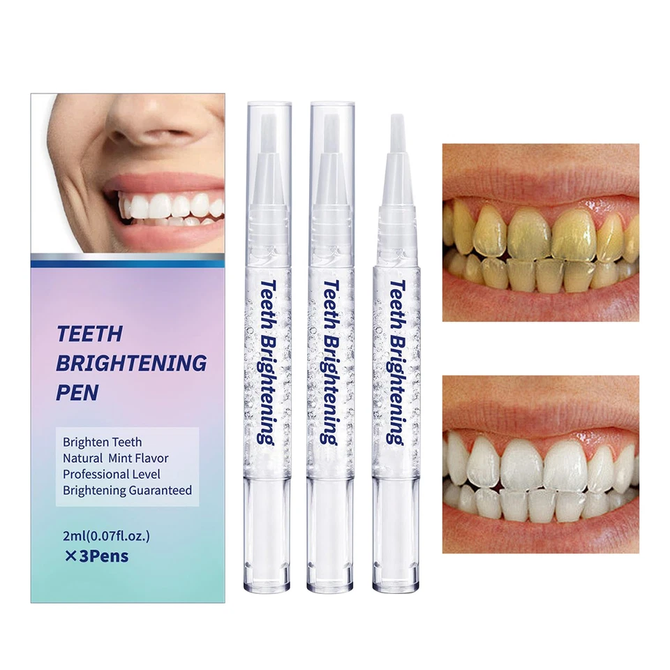 Pluma blanqueadora dental galardonada 3 piezas utiliza quitamanchas de dientes de baja sensibilidad Foto 4 de 4