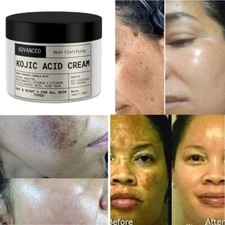 Dark Skin Bleach Body Bleaching Cream Max Strength Whitening Lightening fs