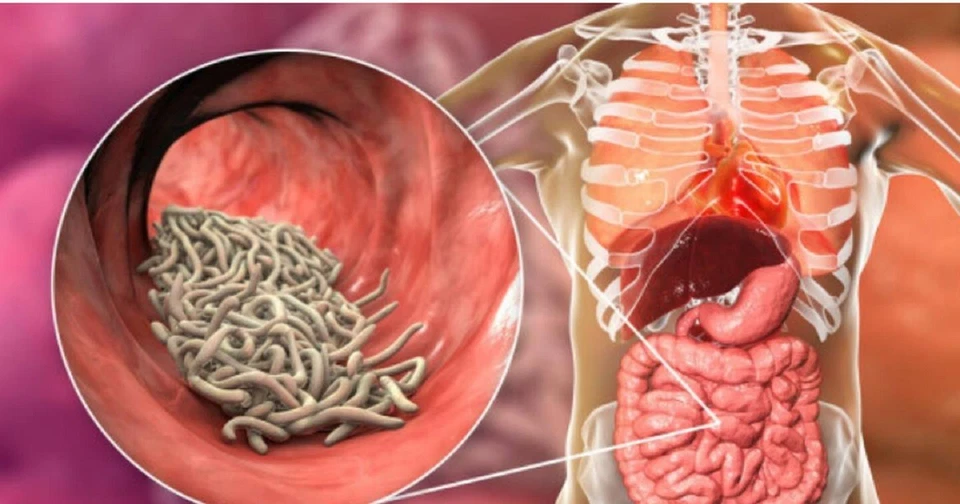 Desparasitante natural para hombre y mujer formulado para matar, enjuagar gusanos parásitos huevos Foto 2 de 4
