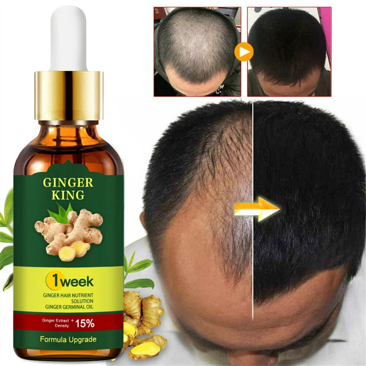 Products to make hair 2024 grow faster and thicker