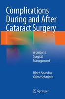 Ulrich Spandau (U. A.) | Complications During And After Cataract Surgery | Buch