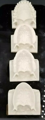 Dental Set Of 4 Mounted Maxillary ridge maxilla Model 