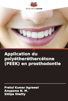 Application Du PolyéTheréThercéTone (Peek) En Prosthodontie Pratul Kumar Agrawal